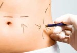 cirurgia-plastica-augusta-1363700725