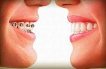 Odontoprev - Foto 1